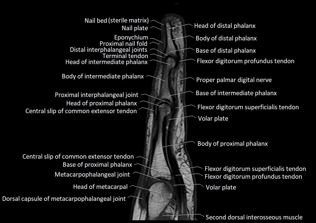 Finger anatomy sagittall cross section 3T image 6.webp